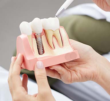 Patient holding a dental implant model.
